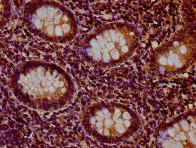 IHC image of HIST1H1D (Ab-90) Antibody diluted at 1:20 and staining in paraffin-embedded human appendix tissue performed on a Leica BondTM system. After dewaxing and hydration, antigen retrieval was mediated by high pressure in a citrate buffer (pH 6.0). Section was blocked with 10% normal goat serum 30min at RT. Then primary antibody (1% BSA) was incubated at 4°C overnight. The primary is detected by a biotinylated secondary antibody and visualized using an HRP conjugated SP system.Rabbit anti-Human HIST1H1D Polyclonal Antibody