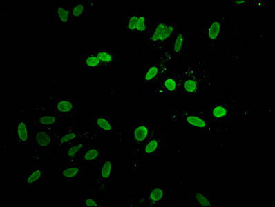 Immunofluorescent analysis of Hela cells using HIST1H1D (Ab-140) Antibody at dilution of 1:100 and Alexa Fluor 488-congugated AffiniPure Goat Anti-Rabbit IgG(H+L)Rabbit anti-Human HIST1H1D Polyclonal Antibody