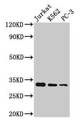 Western Blot  | Positive WB detected in: Jurkat whole cell lysate, K562 whole cell lysate, PC-3 whole cell lysate  | All lanes: HIST1H1D antibody at 1:166  | Secondary  | Goat polyclonal to rabbit IgG at 1/50000 dilution  | Predicted band size: 23 kDa  | Observed band size: 32 kDaRabbit anti-Human HIST1H1D Polyclonal Antibody