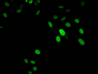 Immunofluorescent analysis of Hela cells using HIST1H1D (Ab-146) Antibody at dilution of 1:100 and Alexa Fluor 488-congugated AffiniPure Goat Anti-Rabbit IgG(H+L)Rabbit anti-Human HIST1H1D Polyclonal Antibody