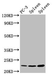 Western Blot  | Positive WB detected in: PC-3 whole cell lysate, Rat spleen tissue, Mouse spleen tissue  | All lanes: HIST1H1D antibody at 1.5µg/ml  | Secondary  | Goat polyclonal to rabbit IgG at 1/50000 dilution  | Predicted band size: 23 kDa  | Observed band size: 23 kDaRabbit anti-Human HIST1H1D Polyclonal Antibody