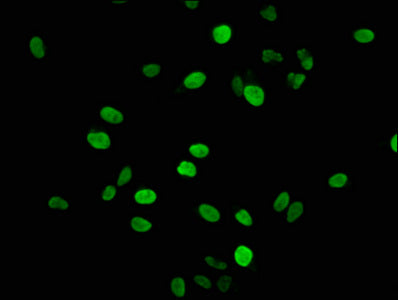 Immunofluorescence staining of Hela cells with HIST1H1E (Ab-17) Antibody at 1:2.5, counter-stained with DAPI. The cells were fixed in 4% formaldehyde, permeabilized using 0.2% Triton X-100 and blocked in 10% normal Goat Serum. The cells were then incubated with the antibody overnight at 4°C. The secondary antibody was Alexa Fluor 488-congugated AffiniPure Goat Anti-Rabbit IgG(H+L).Rabbit anti-Human HIST1H1E Polyclonal Antibody