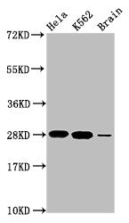 Western Blot  | Positive WB detected in: Hela whole cell lysate, K562 whole cell lysate, Rat brain tissue  | All lanes: HIST1H1E antibody at 1.48µg/ml  | Secondary  | Goat polyclonal to rabbit IgG at 1/50000 dilution  | Predicted band size: 22 kDa  | Observed band size: 28 kDaRabbit anti-Human HIST1H1E Polyclonal Antibody