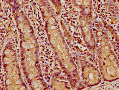 IHC image of HIST1H1E (Ab-45) Antibody diluted at 1:5 and staining in paraffin-embedded human small intestine tissue performed on a Leica BondTM system. After dewaxing and hydration, antigen retrieval was mediated by high pressure in a citrate buffer (pH 6.0). Section was blocked with 10% normal goat serum 30min at RT. Then primary antibody (1% BSA) was incubated at 4°C overnight. The primary is detected by a biotinylated secondary antibody and visualized using an HRP conjugated SP system.Rabbit anti-Human HIST1H1E Polyclonal Antibody