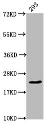Western Blot  | Positive WB detected in: 293 whole cell lysate  | All lanes: HIST1H1E antibody at 0.94µg/ml  | Secondary  | Goat polyclonal to rabbit IgG at 1/50000 dilution  | Predicted band size: 22 kDa  | Observed band size: 22 kDaRabbit anti-Human HIST1H1E Polyclonal Antibody