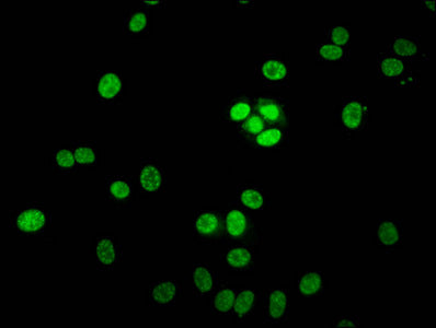 Immunofluorescent analysis of MCF-7 cells using HIST1H1E (Ab-3) Antibody at dilution of 1:100 and Alexa Fluor 488-congugated AffiniPure Goat Anti-Rabbit IgG(H+L)Rabbit anti-Human HIST1H1E Polyclonal Antibody