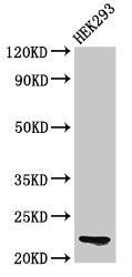 Western Blot  | Positive WB detected in: HEK293 whole cell lysate  | All lanes: HIST1H1E antibody at 0.1µg/ml  | Secondary  | Goat polyclonal to rabbit IgG at 1/50000 dilution  | Predicted band size: 22 kDa  | Observed band size: 22 kDaRabbit anti-Human HIST1H1E Polyclonal Antibody