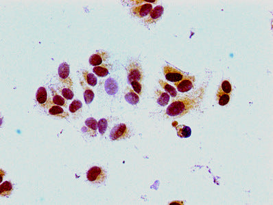 Immunocytochemistry analysis of MCF-7 cells using the antibody at dilution of 1:100Rabbit anti-Human HIST1H1E Polyclonal Antibody