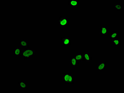 Immunofluorescent analysis of MCF-7 cells (sodium butyrate, 30 mM, 4h) using Acetyl-HIST1H1E (K16) Antibody at dilution of 1:100 and Alexa Fluor 488-congugated AffiniPure Goat Anti-Rabbit IgG(H+L)Rabbit anti-Human HIST1H1E Polyclonal Antibody