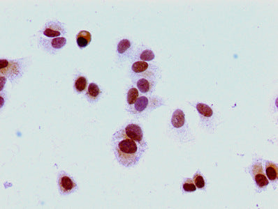 Immunocytochemistry analysis of MCF-7 cells using the antibody at dilution of 1:100Rabbit anti-Human HIST1H1E Polyclonal Antibody