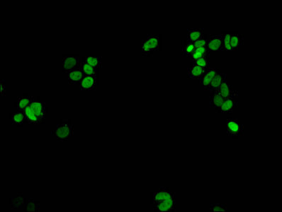 Immunofluorescent analysis of MCF-7 cells using Di-methyl-HIST1H1E (K16) Antibody at dilution of 1:100 and Alexa Fluor 488-congugated AffiniPure Goat Anti-Rabbit IgG(H+L)Rabbit anti-Human HIST1H1E Polyclonal Antibody