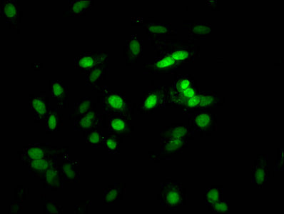 Immunofluorescent analysis of Hela cells using HIST1H1E (Ab-16) Antibody at dilution of 1:100 and Alexa Fluor 488-congugated AffiniPure Goat Anti-Rabbit IgG(H+L)Rabbit anti-Human HIST1H1E Polyclonal Antibody