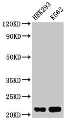Western Blot  | Positive WB detected in: HEK293 whole cell lysate, K562 whole cell lysate  | All lanes: HIST1H1E antibody at 0.5µg/ml  | Secondary  | Goat polyclonal to rabbit IgG at 1/50000 dilution  | Predicted band size: 22 kDa  | Observed band size: 22 kDaRabbit anti-Human HIST1H1E Polyclonal Antibody
