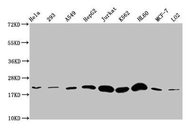 Western Blot  | Positive WB detected in: Hela whole cell lysate, 293 whole cell lysate, A549 whole cell lysate, HepG2 whole cell lysate, Jurkat whole cell lysate, K562 whole cell lysate, HL60 whole cell lysate, MCF-7 whole cell lysate, LO2 whole cell lysate  | All lanes: HIST1H1E antibody at 1:500  | Secondary  | Goat polyclonal to rabbit IgG at 1/40000 dilution  | Predicted band size: 22 kDa  | Observed band size: 22 kDaRabbit anti-Human HIST1H1E Polyclonal Antibody