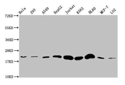 Western Blot  | Positive WB detected in: Hela whole cell lysate, 293 whole cell lysate, A549 whole cell lysate, HepG2 whole cell lysate, Jurkat whole cell lysate, K562 whole cell lysate, HL60 whole cell lysate, MCF-7 whole cell lysate, LO2 whole cell lysate  | All lanes: HIST1H1E antibody at 1:500  | Secondary  | Goat polyclonal to rabbit IgG at 1/40000 dilution  | Predicted band size: 22 kDa  | Observed band size: 22 kDaRabbit anti-Human HIST1H1E Polyclonal Antibody