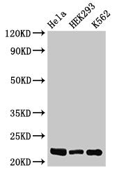 Western Blot  | Positive WB detected in: Hela whole cell lysate, HEK293 whole cell lysate, K562 whole cell lysate  | All lanes: HIST1H1E antibody at 0.5µg/ml  | Secondary  | Goat polyclonal to rabbit IgG at 1/50000 dilution  | Predicted band size: 22 kDa  | Observed band size: 22 kDaRabbit anti-Human HIST1H1E Polyclonal Antibody