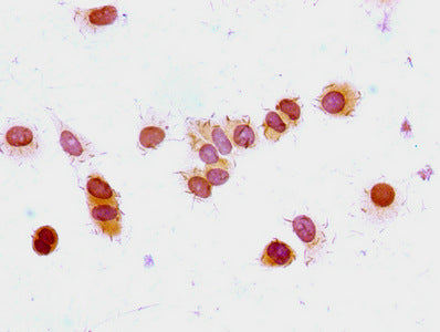 Immunocytochemistry analysis of MCF-7 cells using the antibody at dilution of 1:100Rabbit anti-Human HIST1H1E Polyclonal Antibody