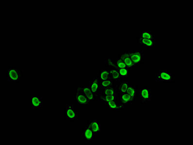 Immunofluorescent analysis of MCF-7 cells (sodium butyrate, 30 mM, 4h) using Acetyl-HIST1H1E (K33) Antibody at dilution of 1:100 and Alexa Fluor 488-congugated AffiniPure Goat Anti-Rabbit IgG(H+L)Rabbit anti-Human HIST1H1E Polyclonal Antibody