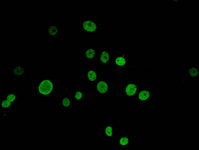 Immunofluorescent analysis of MCF-7 cells using HIST1H1E (Ab-33) Antibody at dilution of 1:100 and Alexa Fluor 488-congugated AffiniPure Goat Anti-Rabbit IgG(H+L)Rabbit anti-Human HIST1H1E Polyclonal Antibody