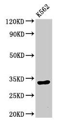 Western Blot  | Positive WB detected in: K562 whole cell lysate  | All lanes: HIST1H1E antibody at 0.5µg/ml  | Secondary  | Goat polyclonal to rabbit IgG at 1/50000 dilution  | Predicted band size: 22 kDa  | Observed band size: 32 kDaRabbit anti-Human HIST1H1E Polyclonal Antibody