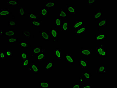 Immunofluorescent analysis of Hela cells (sodium butyrate, 30 mM, 4h) using Acetyl-HIST1H1E (K51) Antibody at dilution of 1:100 and Alexa Fluor 488-congugated AffiniPure Goat Anti-Rabbit IgG(H+L)Rabbit anti-Human HIST1H1E Polyclonal Antibody
