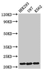Western Blot  | Positive WB detected in: HEK293 whole cell lysate, U87 whole cell lysate, K562 whole cell lysate  | All lanes: HIST1H1E antibody at 1.5µg/ml  | Secondary  | Goat polyclonal to rabbit IgG at 1/50000 dilution  | Predicted band size: 22 kDa  | Observed band size: 22 kDaRabbit anti-Human HIST1H1E Polyclonal Antibody