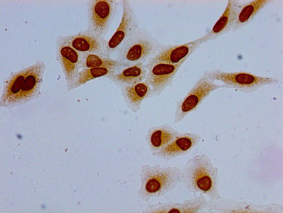 Immunocytochemistry analysis of Hela cells using the antibody at dilution of 1:100Rabbit anti-Human HIST1H1E Polyclonal Antibody