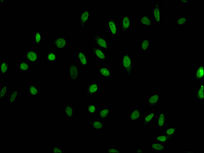 Immunofluorescent analysis of Hela cells (sodium butyrate, 30 mM, 4h) using Acetyl-HIST1H1E (K63) Antibody at dilution of 1:100 and Alexa Fluor 488-congugated AffiniPure Goat Anti-Rabbit IgG(H+L)Rabbit anti-Human HIST1H1E Polyclonal Antibody
