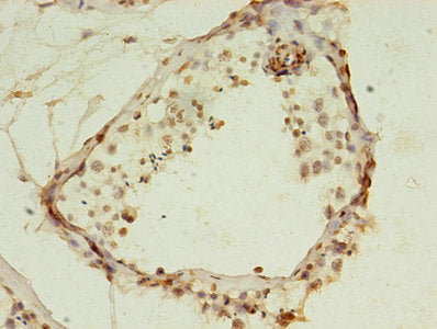 Immunohistochemistry of paraffin-embedded human testis tissue using HIST1H2AG Antibody at dilution of 1:100Rabbit anti-Human HIST1H2AG Polyclonal Antibody