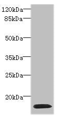 Western blot  | All lanes: HIST1H2AG antibody at 4µg/ml + HL60 whole cell lysate  | Secondary  | Goat polyclonal to rabbit IgG at 1/10000 dilution  | Predicted band size: 15 kDa  | Observed band size: 15 kDaRabbit anti-Human HIST1H2AG Polyclonal Antibody