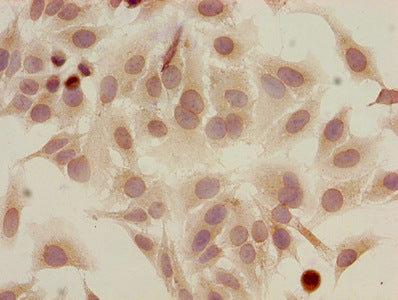 Immunocytochemistry analysis of Hela cells using Acetyl-HIST1H2AG (K5) Antibody at dilution of 1:100Rabbit anti-Human HIST1H2AG Polyclonal Antibody