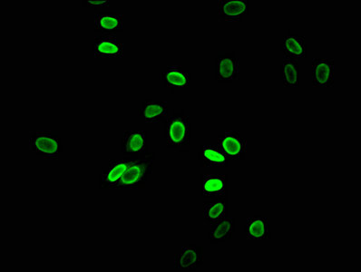 Immunofluorescent analysis of Hela cells using Acetyl-HIST1H2AG (K5) Antibody at dilution of 1:100 and Alexa Fluor 488-congugated AffiniPure Goat Anti-Rabbit IgG(H+L)Rabbit anti-Human HIST1H2AG Polyclonal Antibody