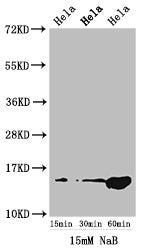 Western Blot  | Positive WB detected in: Hela cell acid extracts treated by NaB  | All lanes: HIST1H2AG antibody at 1.5µg/ml  | Secondary  | Goat polyclonal to rabbit IgG at 1/50000 dilution  | Predicted band size: 15 kDa  | Observed band size: 15 kDaRabbit anti-Human HIST1H2AG Polyclonal Antibody