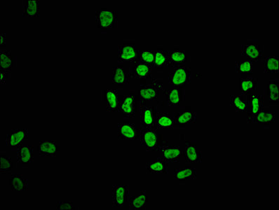Immunofluorescence staining of Hela cells with HIST1H2AG (Ab-5) Antibody at 1:1.5, counter-stained with DAPI. The cells were fixed in 4% formaldehyde, permeabilized using 0.2% Triton X-100 and blocked in 10% normal Goat Serum. The cells were then incubated with the antibody overnight at 4°C. The secondary antibody was Alexa Fluor 488-congugated AffiniPure Goat Anti-Rabbit IgG(H+L).Rabbit anti-Human HIST1H2AG Polyclonal Antibody