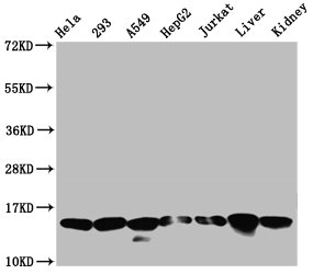 Western Blot  | Positive WB detected in: Hela whole cell lysate, 293 whole cell lysate, A549 whole cell lysate, HepG2 whole cell lysate, Jurkat whole cell lysate, Rat liver tissue, Rat kidney tissue  | All lanes: HIST1H2AG antibody at 0.21µg/ml  | Secondary  | Goat polyclonal to rabbit IgG at 1/50000 dilution  | Predicted band size: 15 kDa  | Observed band size: 15 kDaRabbit anti-Human HIST1H2AG Polyclonal Antibody
