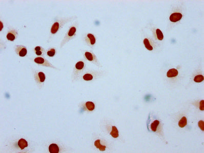 Immunocytochemistry analysis of Mono-methyl-HIST1H2AG (K9) Antibody diluted at 1:10 and staining in Hela cells performed on a Leica BondTM system. The cells were fixed in 4% formaldehyde, permeabilized using 0.2% Triton X-100 and blocked with 10% normal goat serum 30min at RT. Then primary antibody (1% BSA) was incubated at 4°C overnight. The primary is detected by a biotinylated secondary antibody and visualized using an HRP conjugated SP system.Rabbit anti-Human HIST1H2AG Polyclonal Antibody