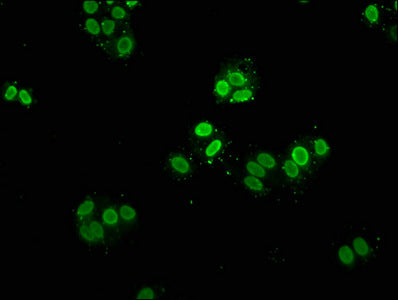 Immunofluorescence staining of Hela cells with the antibody at 1:5, counter-stained with DAPI. The cells were fixed in 4% formaldehyde, permeabilized using 0.2% Triton X-100 and blocked in 10% normal Goat Serum. The cells were then incubated with the antibody overnight at 4°C. The secondary antibody was Alexa Fluor 488-congugated AffiniPure Goat Anti-Rabbit IgG(H+L).Rabbit anti-Human HIST1H2AG Polyclonal Antibody