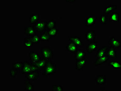 Immunofluorescence staining of Hela cells with HIST1H2AG (Ab-9) Antibody at 1:1, counter-stained with DAPI. The cells were fixed in 4% formaldehyde, permeabilized using 0.2% Triton X-100 and blocked in 10% normal Goat Serum. The cells were then incubated with the antibody overnight at 4°C. The secondary antibody was Alexa Fluor 488-congugated AffiniPure Goat Anti-Rabbit IgG(H+L).Rabbit anti-Human HIST1H2AG Polyclonal Antibody
