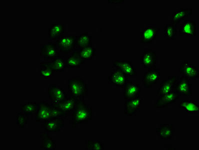 Immunofluorescence staining of Hela cells with HIST1H2AG (Ab-9) Antibody at 1:1, counter-stained with DAPI. The cells were fixed in 4% formaldehyde, permeabilized using 0.2% Triton X-100 and blocked in 10% normal Goat Serum. The cells were then incubated with the antibody overnight at 4°C. The secondary antibody was Alexa Fluor 488-congugated AffiniPure Goat Anti-Rabbit IgG(H+L).Rabbit anti-Human HIST1H2AG Polyclonal Antibody