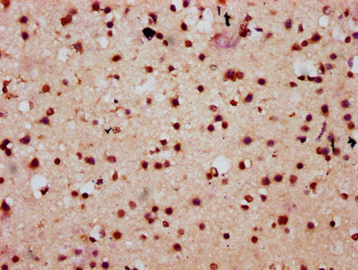 IHC image of HIST1H2AG (Ab-9) Antibody diluted at 1:10 and staining in paraffin-embedded human brain tissue performed on a Leica BondTM system. After dewaxing and hydration, antigen retrieval was mediated by high pressure in a citrate buffer (pH 6.0). Section was blocked with 10% normal goat serum 30min at RT. Then primary antibody (1% BSA) was incubated at 4°C overnight. The primary is detected by a biotinylated secondary antibody and visualized using an HRP conjugated SP system.Rabbit anti-Human HIST1H2AG Polyclonal Antibody