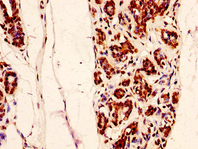 IHC image of HIST1H2AG (Ab-9) Antibody diluted at 1:50 and staining in paraffin-embedded human breast cancer performed on a Leica BondTM system. After dewaxing and hydration, antigen retrieval was mediated by high pressure in a citrate buffer (pH 6.0). Section was blocked with 10% normal goat serum 30min at RT. Then primary antibody (1% BSA) was incubated at 4°C overnight. The primary is detected by a biotinylated secondary antibody and visualized using an HRP conjugated SP system.Rabbit anti-Human HIST1H2AG Polyclonal Antibody