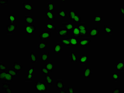 Immunofluorescence staining of Hela cells with HIST1H2AG (Ab-9) Antibody at 1:1, counter-stained with DAPI. The cells were fixed in 4% formaldehyde, permeabilized using 0.2% Triton X-100 and blocked in 10% normal Goat Serum. The cells were then incubated with the antibody overnight at 4°C. The secondary antibody was Alexa Fluor 488-congugated AffiniPure Goat Anti-Rabbit IgG(H+L).Rabbit anti-Human HIST1H2AG Polyclonal Antibody
