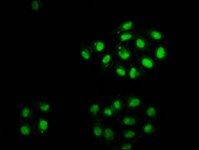 Immunofluorescence staining of Hela cells with HIST1H2AG (Ab-118) Antibody at 1:2.5, counter-stained with DAPI. The cells were fixed in 4% formaldehyde, permeabilized using 0.2% Triton X-100 and blocked in 10% normal Goat Serum. The cells were then incubated with the antibody overnight at 4°C. The secondary antibody was Alexa Fluor 488-congugated AffiniPure Goat Anti-Rabbit IgG(H+L).Rabbit anti-Human HIST1H2AG Polyclonal Antibody