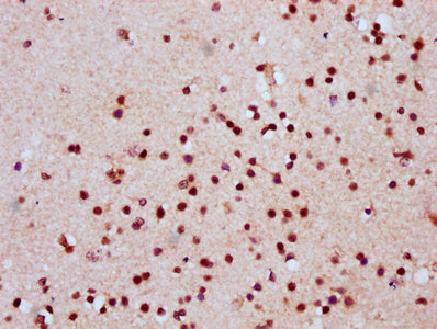 IHC image of the antibody diluted at 1:20 and staining in paraffin-embedded human brain tissue performed on a Leica BondTM system. After dewaxing and hydration, antigen retrieval was mediated by high pressure in a citrate buffer (pH 6.0). Section was blocked with 10% normal goat serum 30min at RT. Then primary antibody (1% BSA) was incubated at 4°C overnight. The primary is detected by a biotinylated secondary antibody and visualized using an HRP conjugated SP system.Rabbit anti-Human HIST1H2AG Polyclonal Antibody