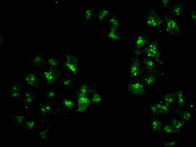 Immunofluorescence staining of Hela cells with HIST1H2AG (Ab-119) Antibody at 1:5, counter-stained with DAPI. The cells were fixed in 4% formaldehyde, permeabilized using 0.2% Triton X-100 and blocked in 10% normal Goat Serum. The cells were then incubated with the antibody overnight at 4°C. The secondary antibody was Alexa Fluor 488-congugated AffiniPure Goat Anti-Rabbit IgG(H+L).Rabbit anti-Human HIST1H2AG Polyclonal Antibody