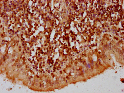 IHC image of the antibody diluted at 1:10 and staining in paraffin-embedded human lung tissue performed on a Leica BondTM system. After dewaxing and hydration, antigen retrieval was mediated by high pressure in a citrate buffer (pH 6.0). Section was blocked with 10% normal goat serum 30min at RT. Then primary antibody (1% BSA) was incubated at 4°C overnight. The primary is detected by a biotinylated secondary antibody and visualized using an HRP conjugated SP system.Rabbit anti-Human HIST1H2AG Polyclonal Antibody