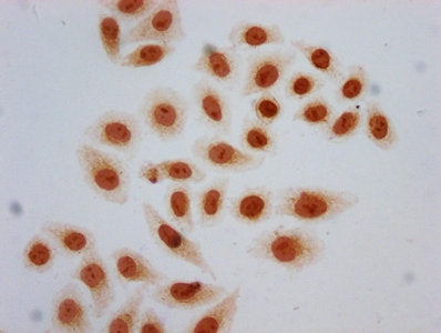 Immunocytochemistry analysis of Acetyl-HIST1H2AG (K13) Antibody diluted at 1:5 and staining in Hela cells (treated with 30mM sodium butyrate for 4h) performed on a Leica BondTM system. The cells were fixed in 4% formaldehyde, permeabilized using 0.2% Triton X-100 and blocked with 10% normal goat serum 30min at RT. Then primary antibody (1% BSA) was incubated at 4°C overnight. The primary is detected by a biotinylated secondary antibody and visualized using an HRP conjugated SP system.Rabbit anti-Human HIST1H2AG Polyclonal Antibody