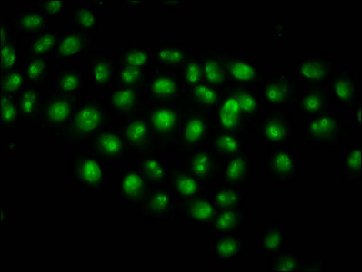 Immunofluorescence staining of Hela cells (treated with 30mM sodium butyrate for 4h) with Acetyl-HIST1H2AG (K13) Antibody at 1:2.5, counter-stained with DAPI. The cells were fixed in 4% formaldehyde, permeabilized using 0.2% Triton X-100 and blocked in 10% normal Goat Serum. The cells were then incubated with the antibody overnight at 4°C. The secondary antibody was Alexa Fluor 488-congugated AffiniPure Goat Anti-Rabbit IgG(H+L).Rabbit anti-Human HIST1H2AG Polyclonal Antibody