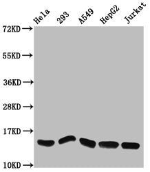 Western Blot  | Positive WB detected in: Hela whole cell lysate, 293 whole cell lysate, A549 whole cell lysate, HepG2 whole cell lysate, Jurkat whole cell lysate  | All lanes: HIST1H2AG antibody at 1.27µg/ml  | Secondary  | Goat polyclonal to rabbit IgG at 1/50000 dilution  | Predicted band size: 15 kDa  | Observed band size: 15 kDaRabbit anti-Human HIST1H2AG Polyclonal Antibody