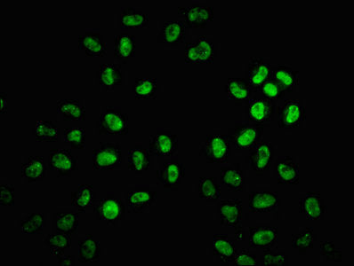 Immunofluorescence staining of Hela cells with HIST1H2AG (Ab-29) Antibody at 1:1, counter-stained with DAPI. The cells were fixed in 4% formaldehyde, permeabilized using 0.2% Triton X-100 and blocked in 10% normal Goat Serum. The cells were then incubated with the antibody overnight at 4°C. The secondary antibody was Alexa Fluor 488-congugated AffiniPure Goat Anti-Rabbit IgG(H+L).Rabbit anti-Human HIST1H2AG Polyclonal Antibody